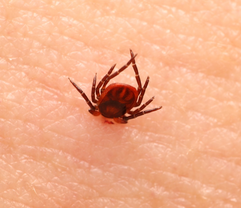 Tick Bites When Should I Worry