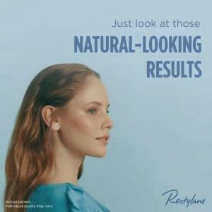 Restylane for natural looking results